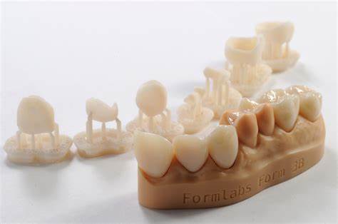 Three-Dimensional Printing Resin-Based Dental Provisional Crowns and Bridges