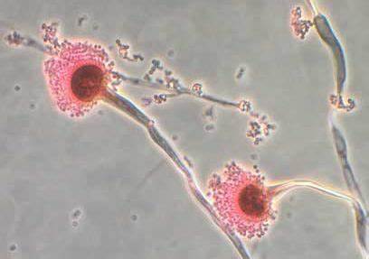 A fungus that can 'eat you from the inside out' could spread as world heats up