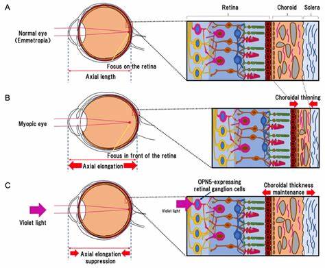 Violet Light Hypothesis for the Control of Myopia Progression