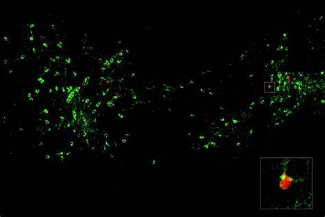 Dopamine signals when a fear can be forgotten