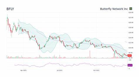 Butterfly Network, Inc. (BFLY): Among Billionaire Larry Robbins’ Stock Picks with Huge Upside Potential