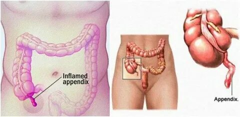 Just scroll till Appendix D