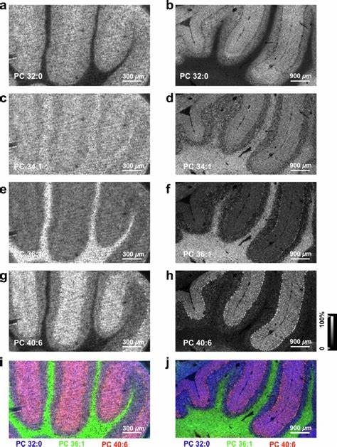 TEMI: Tissue-expansion mass-spectrometry imaging