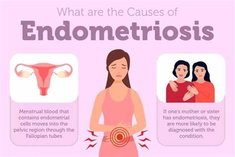 Endometriosis is an incredibly interesting disease