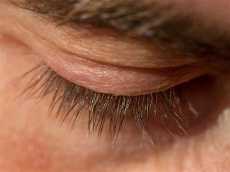 Why men are shaving off their eyelashes
