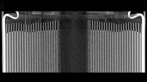 Ultra-Fast CT Scans in as Little as 0.1 Seconds