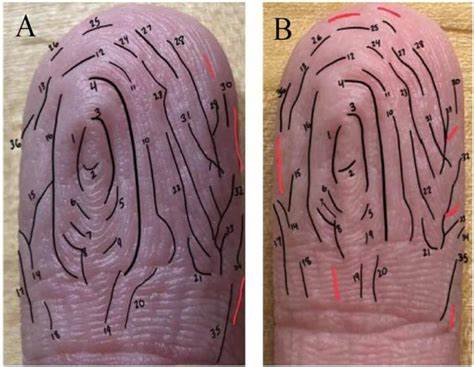 Fingers wrinkle in the same pattern every time