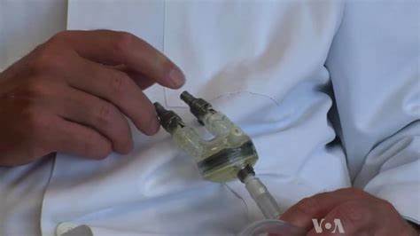 Research at risk: Life-saving heart pumps for babies