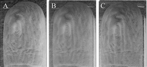 Fingers Wrinkle in the Same Pattern Every Time After Long Exposure to Water