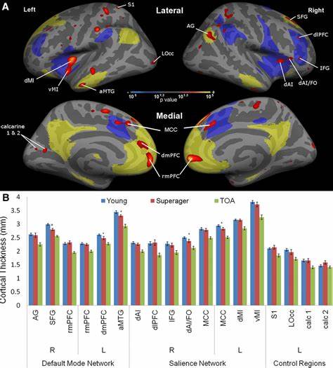 Ismrm: fMRI identifies key brain regions in superagers