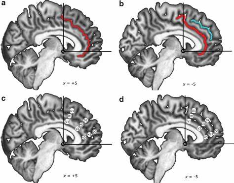Linking functional connectivity to individual sulcal morphology yields insights