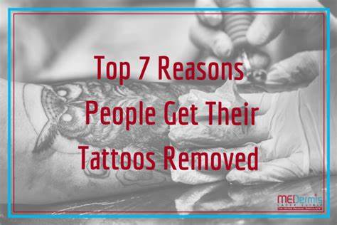 Why Is Everyone Getting Their Tattoos Removed?