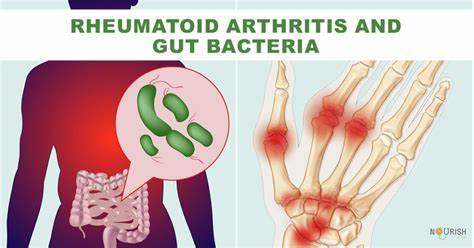 Explaining the link between 'good' gut bacteria and rheumatoid arthritis
