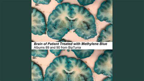 What methylene blue can (and can’t) do for the brain