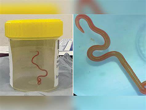 Parasite Infecting Up to 50% of People Can Decapitate Human Sperm