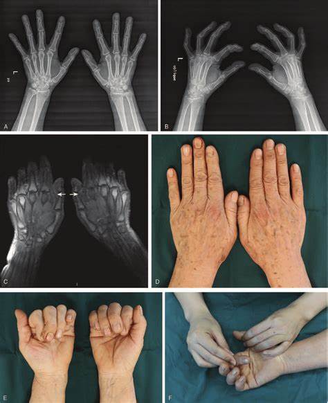 MCP and Knowing When to Care