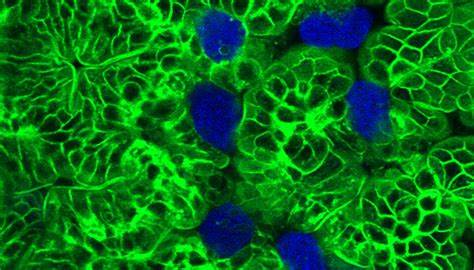 Parasite Kills Human Cells and Wears Their Remains as Disguise