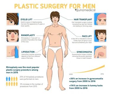 The Plastic Surgery Procedure Booming Among Washington Men