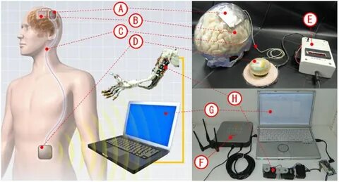 China Kicks Off Human Testing of Implantable Brain-Computer Interface Devices