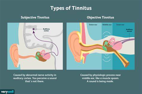 I have tinnitus. I don't recommend it