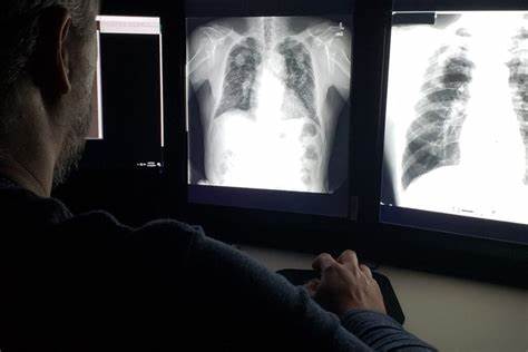 Lung Power Peaks in Our 20s–and It's a Steady Decline from There
