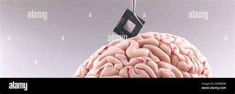 Coming to a Brain Near You: A Tiny Computer