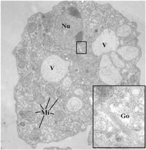 The term "vegetative electron microscopy" keeps showing up in scientific papers