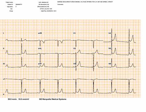 Paper ECG: An open-source application for digitizing ECG image scans