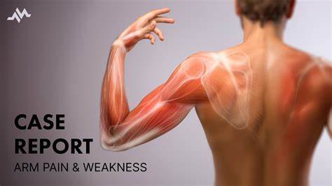 Arm Tumbles After Weak Forecast, Spurring Slowdown Fears
