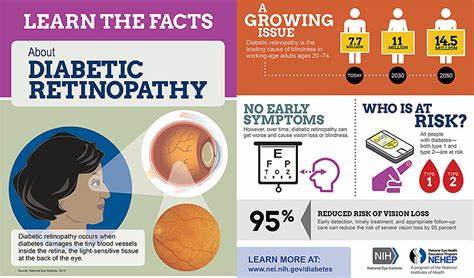 AI for non-mydriatic digital retinography in screening of diabetic retinopathy