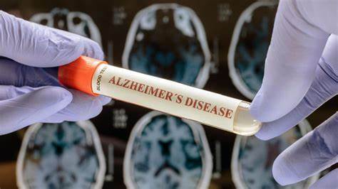 FDA clears first blood test for diagnosing Alzheimer's