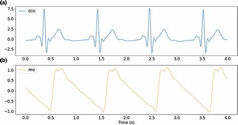 Exploring the Best Input Representation for Electrocardiogram-Language Models